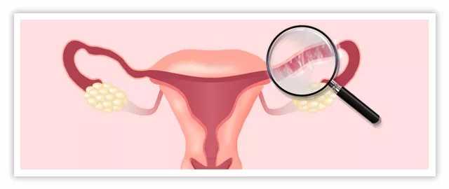 非淋菌性尿道炎的全面防治指南:四种高效方法助您远离困扰