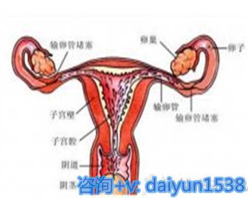 太原代妈招聘与男同性恋试管费用解析，15-20万预算指南